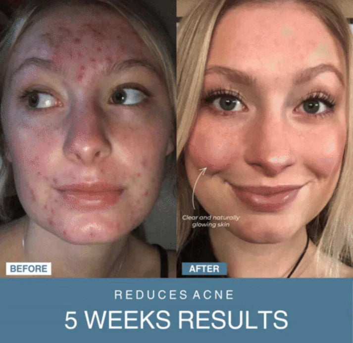 Blush Nest™ 7-in-1 LED Anti-Aging/Wrinkle Apparatus