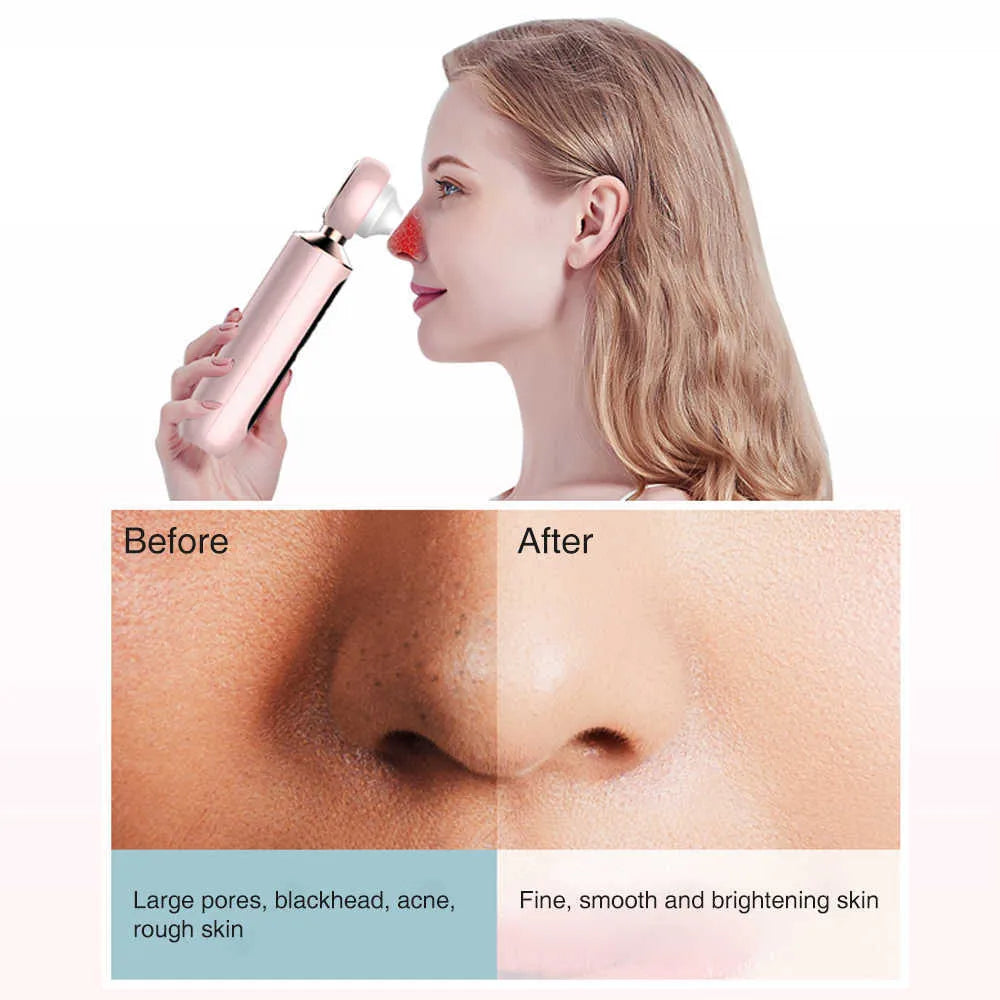 Blush Nest™ Blackhead Suction Machine