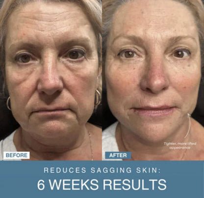 Blush Nest™ 7-in-1 LED Anti-Aging/Wrinkle Apparatus